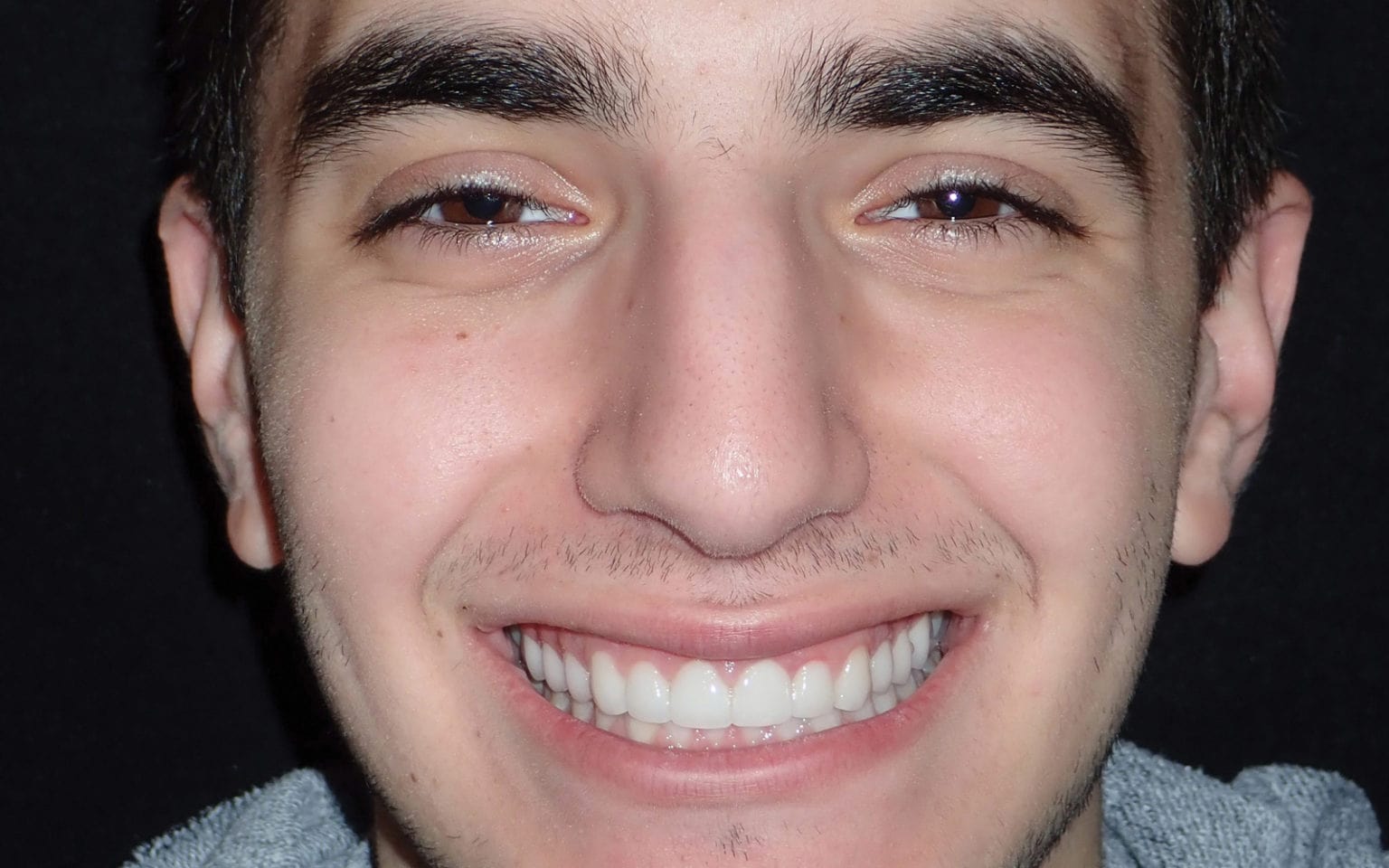 Smile Makeover Top 10 Makeovers for Men from Best Self Atlanta