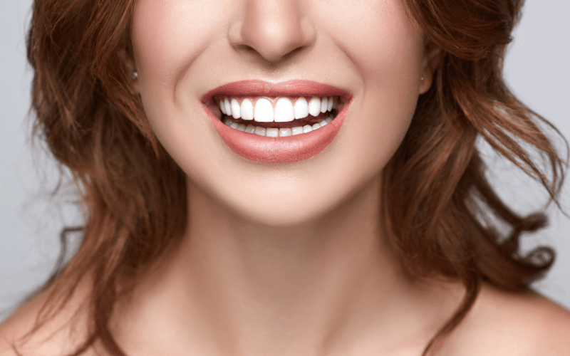 woman with white teeth