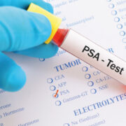 PSA Screening